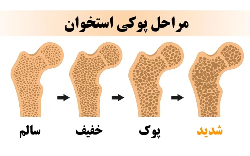 غذاهای دریایی غنی از کلسیم مانند ماهی ساردین و سالمون
